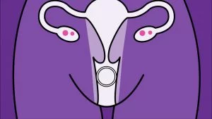 PANCUT DALAM VAGINAL RING