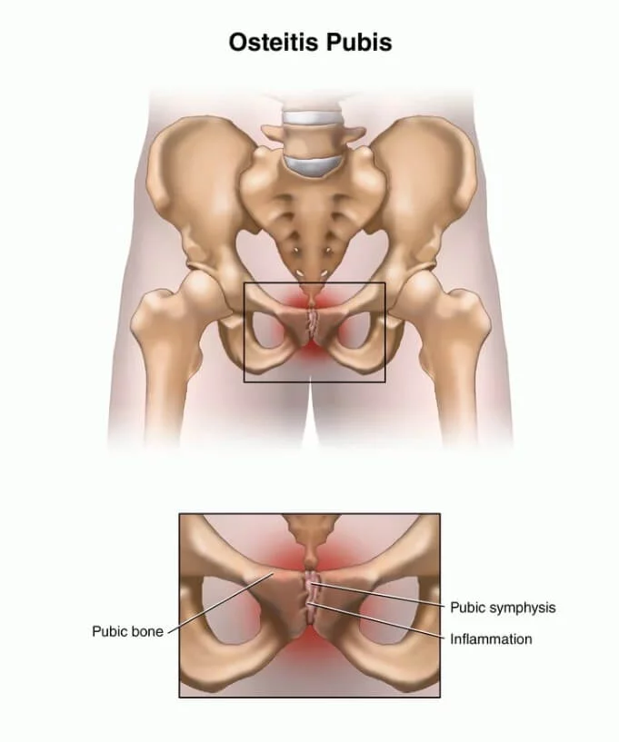 pubic bone tulang pubik wanita