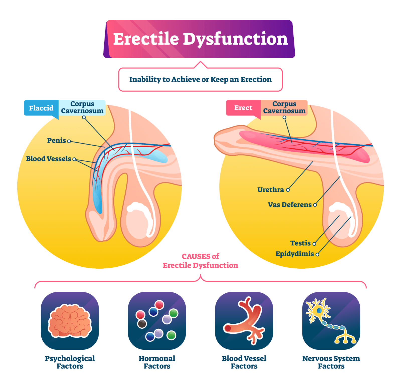 Erectile Dysfunction Clinic Malaysia