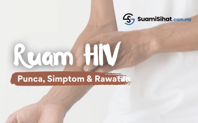 Ruam HIV – Punca, Simptom & Rawatan Yang Wajib Tahu.