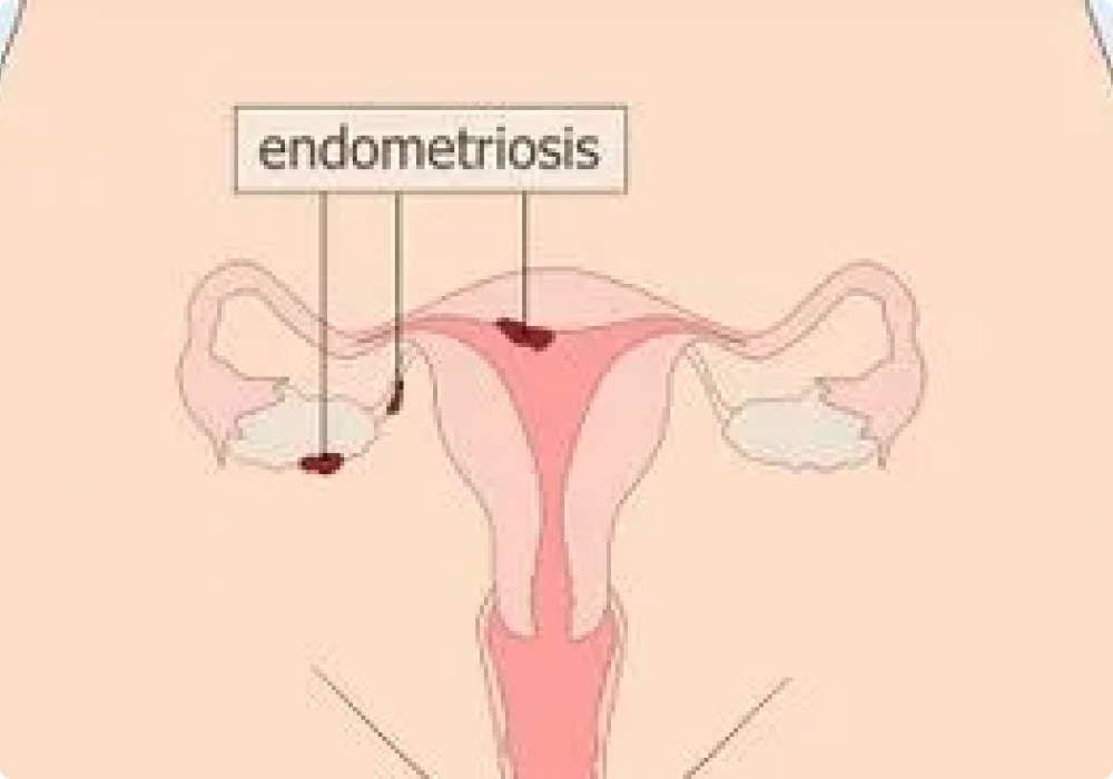 bersetubuh ketika haid hampir kering