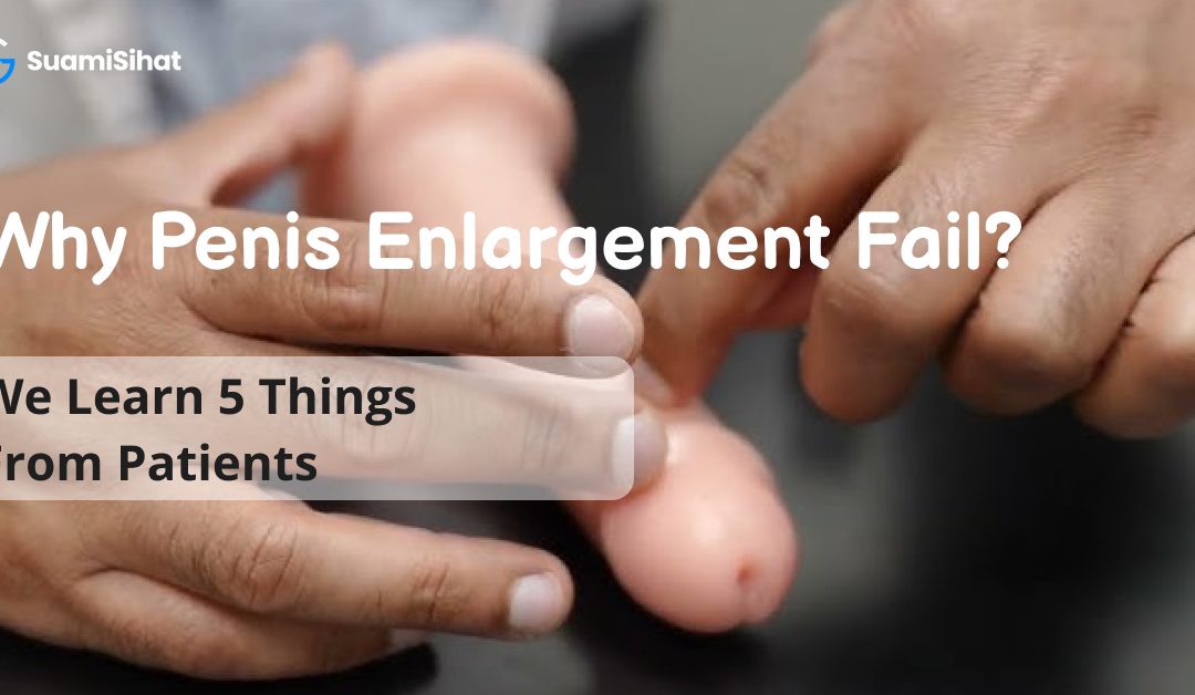 Why Penis Enlargement Fail? We Learn 5 Things From Patients