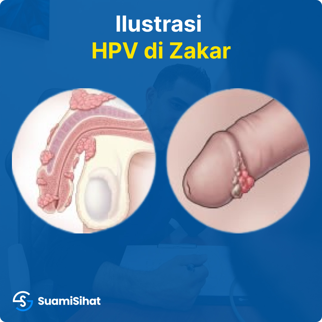 gatal kemaluan lelaki