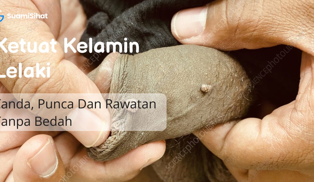 Ketuat Kelamin Lelaki: Tanda, Punca & Rawatan Tanpa Bedah