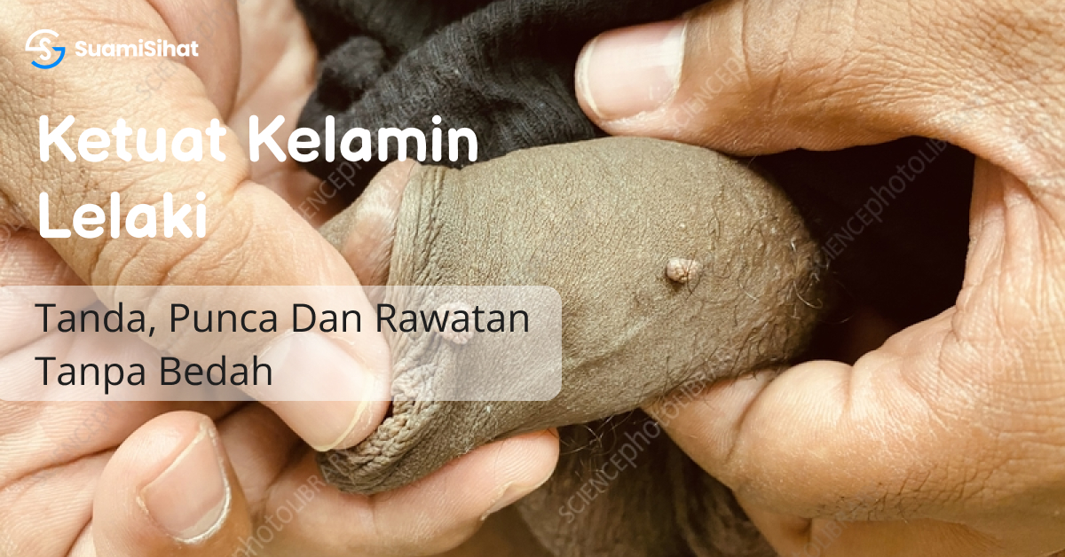 Mujarab-atau-mitos-miyak-lintah-belacak-dhab