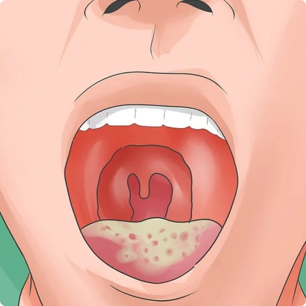 jangka hayat pesakit hiv